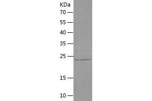 Western Blotting (WB) image for Fibroblast Growth Factor 8 (Androgen-Induced) (FGF8) (AA 53-233) protein (His tag) (ABIN7122948)