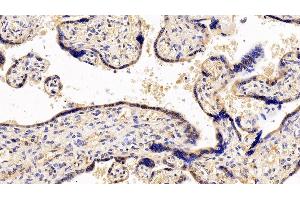 Detection of GCSFR in Human Placenta Tissue using Polyclonal Antibody to Colony Stimulating Factor Receptor, Granulocyte (GCSFR)