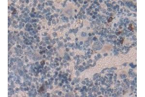 Detection of EMILIN1 in Rat Spleen Tissue using Polyclonal Antibody to Elastin Microfibril Interface Located Protein 1 (EMILIN1) (Emilin1 anticorps  (AA 684-899))