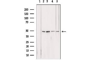 Western blot analysis of extracts from various samples, using ATPB antibody. (ATP5B anticorps  (Internal Region))