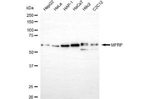 Western blotting analysis using MFRP antibody (ABIN7799363).