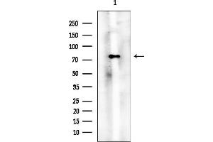 Western blot analysis of lysates from HUVEC cells, using PKC beta 1 Mouse Monoclonal Antibody at 1/1000 dilution.