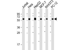 All lanes : Anti-Hsp60 Antibody at 1:16000 dilution Lane 1: Jurkat whole cell lysate Lane 2: Hela whole cell lysate Lane 3: HepG2 whole cell lysate Lane 4: MCF-7 whole cell lysate Lane 5: NIH/3T3 whole cell lysate Lane 6: PC-12 whole cell lysate Lysates/proteins at 20 μg per lane. (HSPD1 anticorps  (AA 396-430))