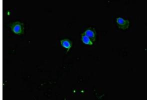 Immunofluorescent analysis of Hela cells using ABIN7148148 at dilution of 1:100 and Alexa Fluor 488-congugated AffiniPure Goat Anti-Rabbit IgG(H+L) (CCDC8 anticorps  (AA 214-513))