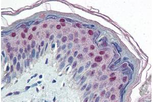 Human Skin (formalin-fixed, paraffin-embedded) stained with CEBPB antibody ABIN364320 at 10 ug/ml followed by biotinylated anti-mouse IgG secondary antibody ABIN481714, alkaline phosphatase-streptavidin and chromogen. (CEBPB anticorps)