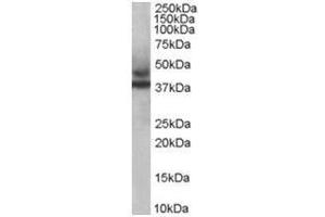 Image no. 1 for anti-Tripartite Motif Containing 54 (TRIM54) (C-Term) antibody (ABIN374312) (TRIM54 anticorps  (C-Term))