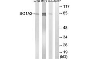 Western Blotting (WB) image for anti-Solute Carrier Organic Anion Transporter Family, Member 1A2 (SLCO1A2) (AA 251-300) antibody (ABIN2890652) (SLCO1A2 anticorps  (AA 251-300))