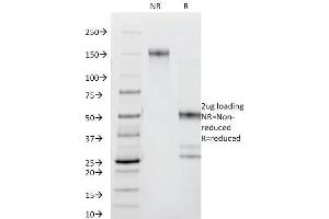 SDS-PAGE Analysis Purified CD44 Mouse Monoclonal Antibody (DF1485).