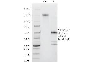 SDS-PAGE Analysis Purified CD44 Mouse Monoclonal Antibody (DF1485). (CD44 anticorps)