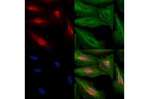 ABIN6259270 and ABIN6274431 staining  cells by IF/ICC.
