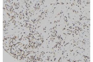 ABIN6267108 at 1/100 staining Human gastric tissue by IHC-P. (Cyclin E1 anticorps  (pThr77))