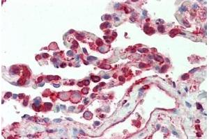 Human Lung: Formalin-Fixed, Paraffin-Embedded (FFPE)