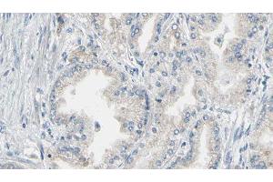 ABIN6276843 at 1/100 staining Human prostate tissue by IHC-P. (Annexin V anticorps  (C-Term))