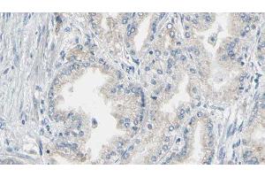 ABIN6276843 at 1/100 staining Human prostate tissue by IHC-P.