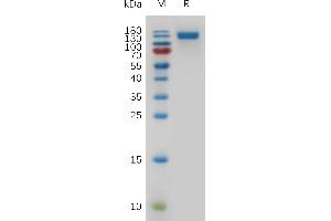 Mouse CD22 Protein, His Tag on SDS-PAGE under reducing condition.