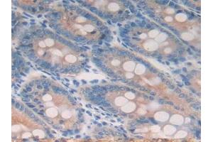 Detection of CK18 in Rat Small intestine Tissue using Polyclonal Antibody to Cytokeratin 18 (CK18)