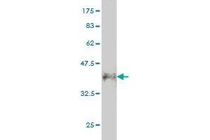Western Blot detection against Immunogen (36. (CALCOCO2 anticorps  (AA 347-446))