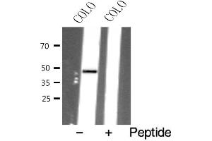 Western blot analysis of extracts from COLO cells using AVPR1B antibody. (AVPR1B anticorps  (Internal Region))