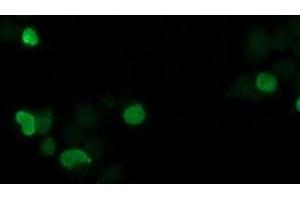 Image no. 4 for anti-Synovial Sarcoma, X Breakpoint 1 (SSX1) antibody (ABIN1501156) (SSX1 anticorps)