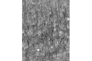 Adult rat cortex immunohistochemistry of axon initial segments. (Ankyrin G anticorps)