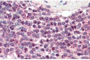 NR1H2 polyclonal antibody  (3 ug/mL) staining of paraffin embedded human spleen. (NR1H2 anticorps)