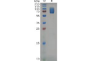 Mouse 2B4 Protein, hFc Tag on SDS-PAGE under reducing condition.