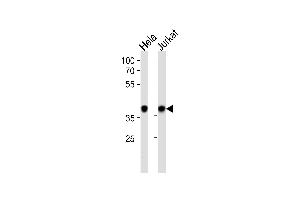 N Antibody (C-term) (ABIN389343 and ABIN2839452) western blot analysis in Hela,Jurkat cell line lysates (35 μg/lane). (NPM1 anticorps  (C-Term))