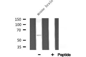 Western blot analysis of ATP5A1 expression in Mouse brain lysate