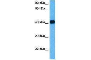 Host:  Mouse  Target Name:  NFKBIB  Sample Tissue:  Mouse Heart  Antibody Dilution:  1ug/ml (NFKBIB anticorps  (N-Term))