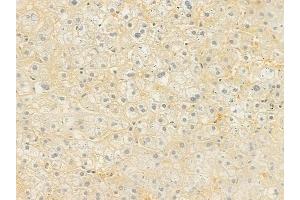 ABIN6262011 and ABIN6277630 at 1/100 staining human normal liver tissue by IHC-P.