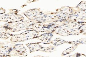 Immunohistochemistry analysis of paraffin-embedded human placenta using,SET (ABIN7075583) at dilution of 1: 10000