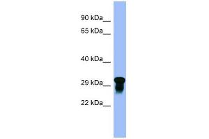 WB Suggested Anti-C10orf54 Antibody Titration:  0. (VISTA anticorps  (N-Term))