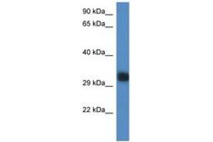 Image no. 1 for anti-Predicted Gene 527 (GM527) (AA 218-267) antibody (ABIN6746331) (GM527 anticorps  (AA 218-267))