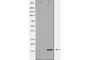 Western blot analysis of A549  using PLA2G2A antibody. (PLA2G2A anticorps  (Internal Region))
