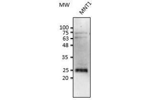Anti-Rab38 Ab at 1/2,500 dilution, Iysates at 50 µg per Iane, rabbit polyclonal to goat (HRP) at 1/10,000 dilution, (RAB38 anticorps  (C-Term))