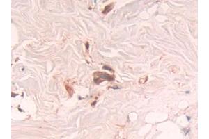 Used in DAB staining on fromalin fixed paraffin-embedded Brain tissue (RNASET2 anticorps  (AA 25-256))