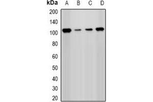 Western blot analysis of PHC1 expression in Hela (A), Jurkat (B), A549 (C), mouse kidney (D) whole cell lysates. (PHC1 anticorps)