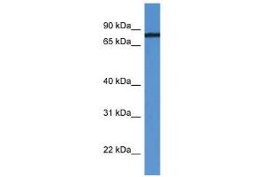 WB Suggested Anti-HHIPL1 Antibody Titration: 0. (HHIPL1 anticorps  (C-Term))