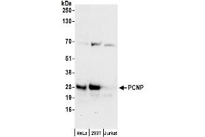 anti-PEST Proteolytic Signal Containing Nuclear Protein (PCNP) (AA 1-50) antibody