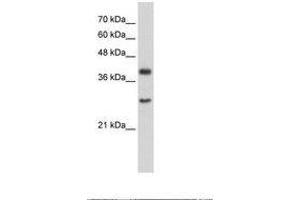 Image no. 1 for anti-Cytosolic Iron-Sulfur Protein Assembly 1 (CIAO1) (AA 247-296) antibody (ABIN203313) (CIAO1 anticorps  (AA 247-296))