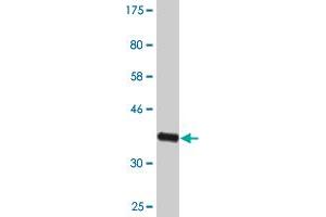 Western Blot detection against Immunogen (35. (NPAS2 anticorps  (AA 646-738))
