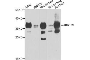 Western blot analysis of extracts of various cell lines, using AKR1C4 antibody (ABIN5975529) at 1/1000 dilution. (AKR1C4 anticorps)