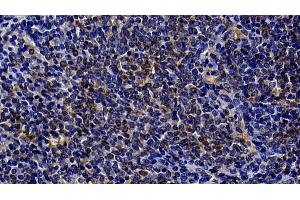 Detection of TLR5 in Rat Spleen Tissue using Polyclonal Antibody to Toll Like Receptor 5 (TLR5) (TLR5 anticorps  (AA 325-644))