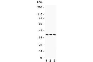Western blot testing of NMI antibody and Lane 1:  human placenta;  2: A549;  3: HeLa
