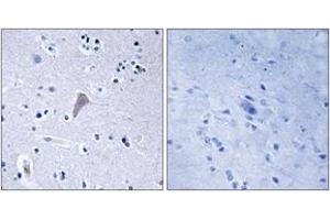 Immunohistochemistry analysis of paraffin-embedded human brain tissue, using mTOR (Ab-2448) Antibody. (MTOR anticorps  (AA 2415-2464))