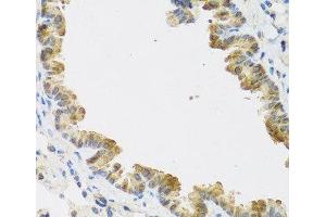 Immunohistochemistry of paraffin-embedded Mouse lung using CDKN2C Polyclonal Antibody at dilution of 1:100 (40x lens).