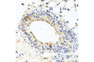 Immunohistochemistry of paraffin-embedded mouse lung using MUC16 antibody (ABIN6003713) at dilution of 1/100 (40x lens).