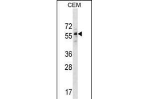 DPH2 Antibody (N-term) (ABIN1538986 and ABIN2849764) western blot analysis in CEM cell line lysates (35 μg/lane). (DPH2 anticorps  (N-Term))