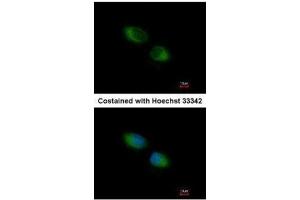 ICC/IF Image Immunofluorescence analysis of methanol-fixed HeLa, using TXNDC1, antibody at 1:500 dilution. (TMX1 anticorps  (C-Term))