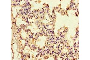 Immunohistochemistry of paraffin-embedded human lung tissue using ABIN7156789 at dilution of 1:100 (IL-13 anticorps  (AA 30-125))